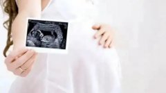 美国试管婴儿：医院排名与生育医疗服务的深度解析