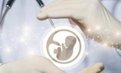 美国做试管婴儿多少钱一次(哪家医院值得信赖)
