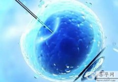 2024去美国试管生男孩安全吗费用多少？附详细成