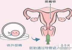 南通附院人工受孕试管费用多少钱？附详细试管