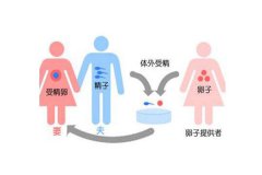 去美国做供卵试管婴儿的具体流程有哪些？