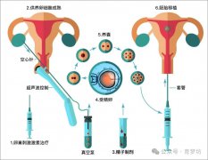 试管婴儿全流程详解，建议收藏！
