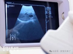各个孕周最新b超股骨长对照表，对比一下就知道是否正常孕周计算b超