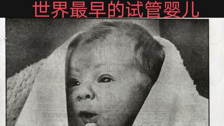 第一个试管婴儿