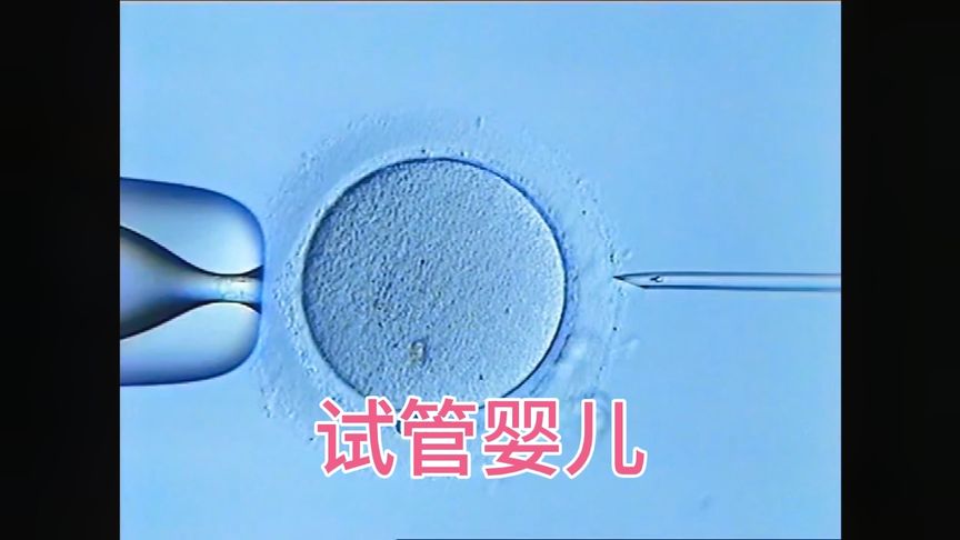 试管婴儿的过程！