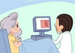 【来点干货】宫腔镜检查注意事项