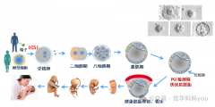 第三代试管婴儿技术能筛查出那些遗传疾病？
