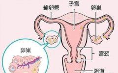 卵巢低反应、 空卵泡怎么办？试管前3个月养出又大又圆卵泡！【合肥试管医院】
