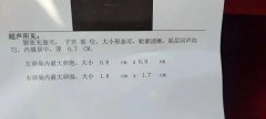 试管婴儿卵子排出后能活4天吗？医生：一般12-24小时